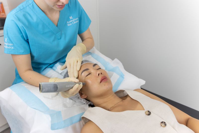Filler - KEEN Clinic real-life clinic reference